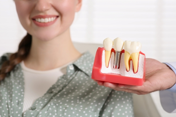 Factors To Consider Before Opting For Dental Implants