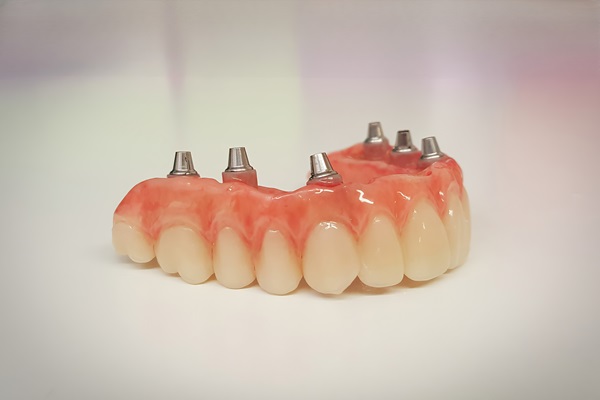 Bring Back A Stronger Smile With Implant Supported Dentures